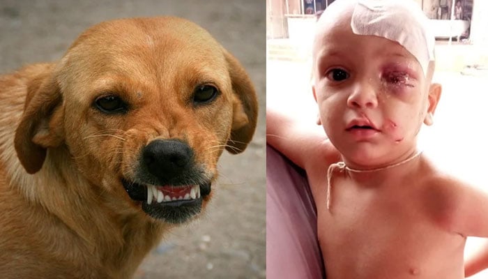 کورنگی، آوارہ کتے نے دو سالہ بچے کو بھنبھوڑ ڈالا، آنکھ ضائع ہونے کا خدشہ