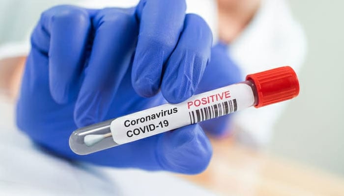 تین بنگلہ دیشی انڈر 19 کرکٹرز میں کورونا وائرس کی تصدیق 