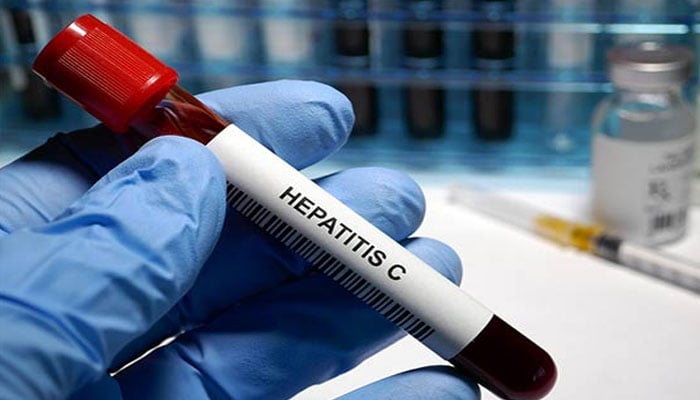 پاکستان میں ہیپاٹائٹس سی کے مریض دنیا میں سب سے زیادہ ہیں