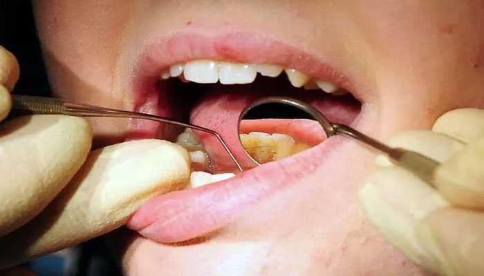 اسکاٹ لینڈ میں دانتوں کے علاج کا نظام شدید متاثر، مریضوں کو سال بھر انتظار کا سامنا