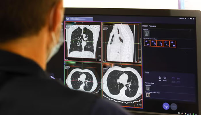 NHS میں بہتری اور ریسرچ پر سرمایہ کاری کینسر سے ہزاروں اموات کو روک سکتی ہیں