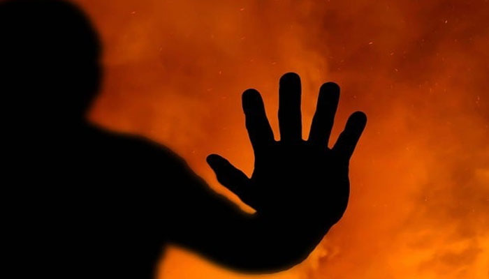 کھارادر، آئل کی دکان میں آگ سے جھلس کر ایک شخص جاں بحق