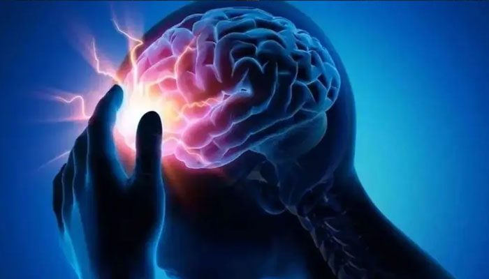 جینیاتی نقائص دماغی فالج کے ایک چوتھائی کیسز کی وجہ ہیں، تحقیق