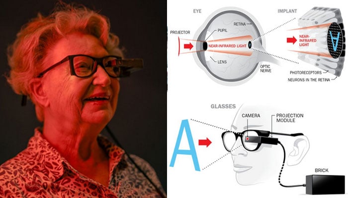 جسم میں نصب کمپیوٹر چِپس سے بینائی کی جزوی بحالی، طب میں نیا انقلاب