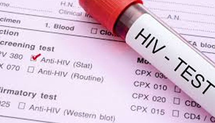 نوابشاہ میں ایچ آئی وی کیسز میں ہولناک اضافہ، عوام میں تشویش کی لہر