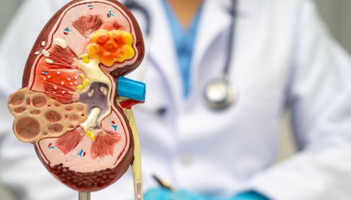 گردوں کے مریض دل کی بیماری سے کیوں مرتے ہیں؟ سائنس دانوں کو پتہ چل گیا