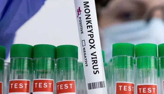 سکھر، منکی پاکس کے 122  کیسز رپورٹ، 25  کی تصدیق، 10  اموات، 2 نئے کیس ظاہر