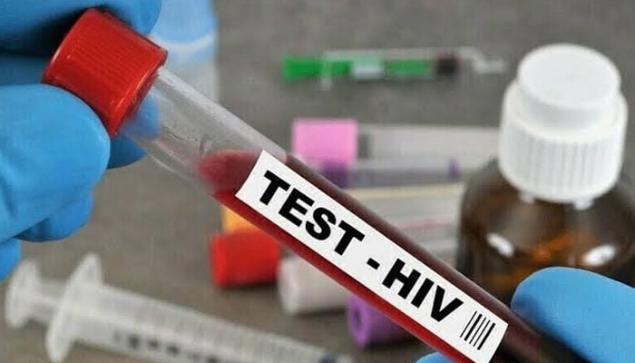 لانڈھی اور ولیکا اسپتالوں میں 130 افراد میں HIV کی تصدیق