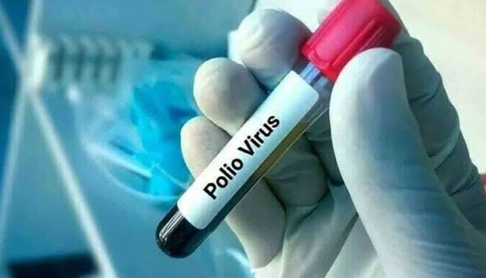کراچی میں 22 ماہ بعد پولیو کا کیس رپورٹ، چھ ماہ کا بچہ متاثر