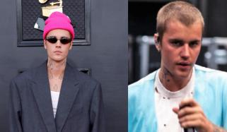 Did Justin Bieber get a secret hair transplant? DETAILS