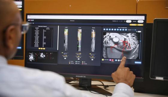 Singapore’s AI-centric 'Sense' system targets precised coronary artery disease diagnosis