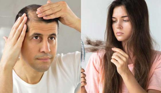 Hair loss explained: Causes, symptoms, and when to see a doctor