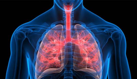 What is Cystic Fibrosis? Symptoms, treatment, diagnoses