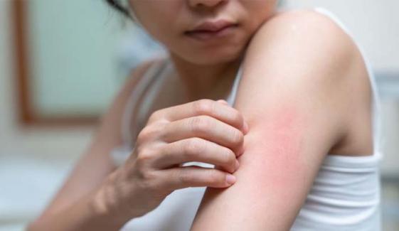 Signs your skin shows about your overall health