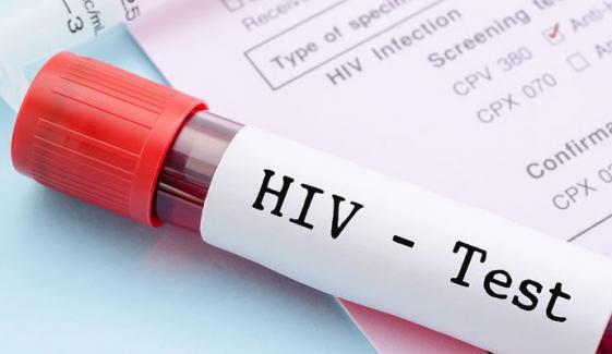 US cuts to HIV aid may lead to 4 million deaths by 2029, UN warns