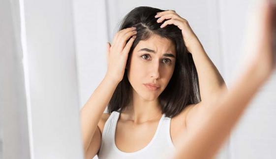 Top home remedies to beat dandruff in 2025