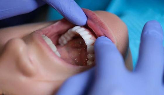 Poor oral health associated with chronic health problems, study