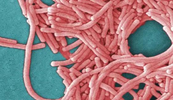 Legionnaires' outbreak returns in London linked to Sofina Foods cooling towers