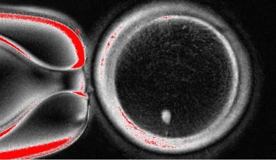 Researchers grow egg-like cells from human skin for fertilisation