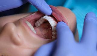 Can cavities and gum disease lead to brain disorders?