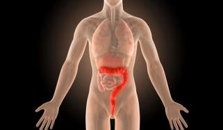 Younger people facing sharp increase in dangerous colon infections, study