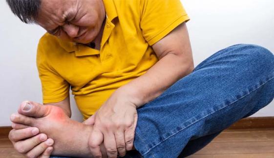 Researchers find gene ties behind fatal skin reactions to Allopurinol