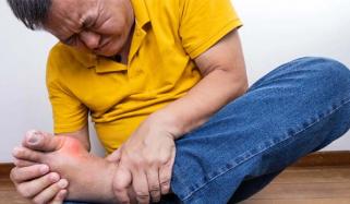 Researchers find gene ties behind fatal skin reactions to Allopurinol