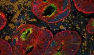 Canada’s measles outbreak causes Americas region to lose elimination status