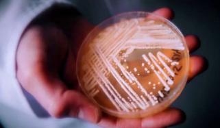 Drug-resistant fungus Candida Auris identified in Connecticut, experts