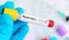 Nipah virus outbreak in India triggers new screenings across Asia
