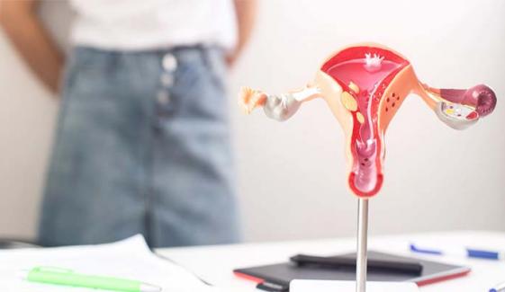Life-saving surgery: Fallopian tube removal reduces cancer risk by 80%