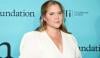 Amy Schumer discusses adverse effects of ‘Botched Colonoscopy’