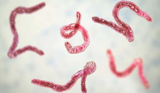 Michigan parasite outbreak infects over 150 people, investigation underway 