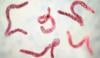 Michigan parasite outbreak infects over 150 people, investigation underway 