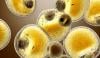 Scientists discover ‘fat metabolism switch’ in human cells for first time