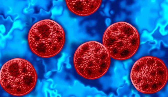 Cyclospora outbreak in US: foods under investigation and how to stay safe