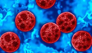 Cyclospora outbreak in US: foods under investigation and how to stay safe
