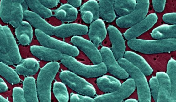 Vibrio vulnificus: Louisiana reports 5 deaths linked to flesh-eating bacteria 