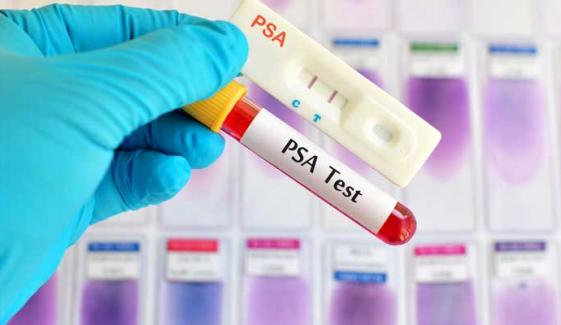 UK men over 50 lose automatic right to prostate cancer tests
