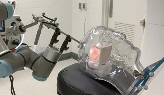 World's first AI-assisted brain surgery performed on UK patient