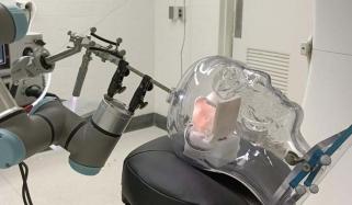 World's first AI-assisted brain surgery performed on UK patient