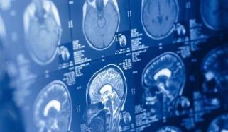 Human brain may be two separate organs, Stanford study finds