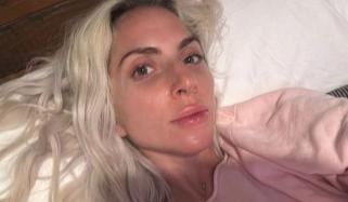 Lady Gaga’s rare health condition: Symptoms, treatment and what to know 