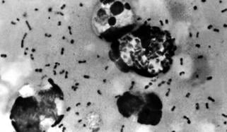 What is pneumonic plague? How dangerous is it and how does it spread?