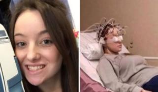 Teen’s terrifying flying Dinosaur hallucination unmasked rare autoimmune brain disorder