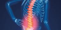 ہڈیوں کا بھر بھراپن ایک خاموش بیماری