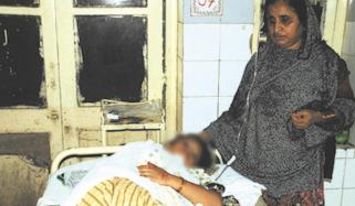 اراضی کا تنازعہ، لڑکی پر تیزاب پھینک کر چہرہ مسخ کردیا