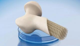 Artificial Bone