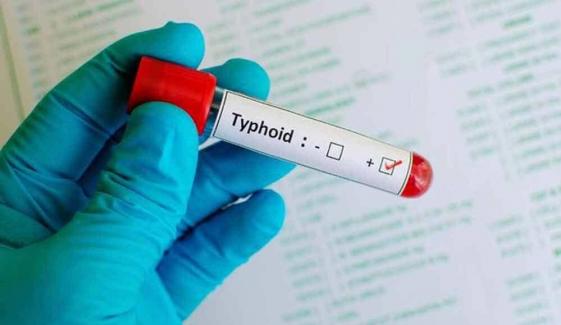 Xdr Typhoid