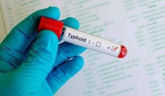 Xdr Typhoid